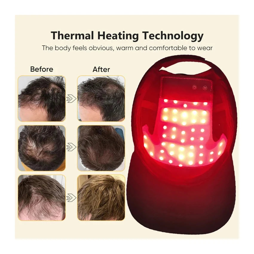 LED Red Light Therapy Hair Growth Cap – Laser Helmet for Hair Regrowth
