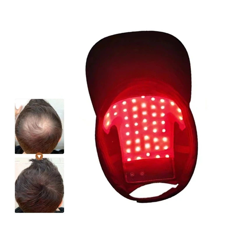 LED Red Light Therapy Hair Growth Cap – Laser Helmet for Hair Regrowth